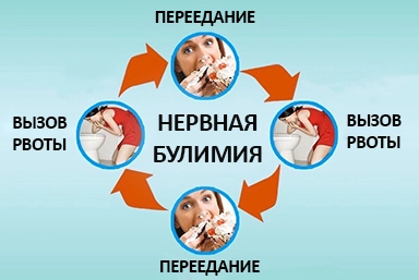 Лечение булимии в Торопце